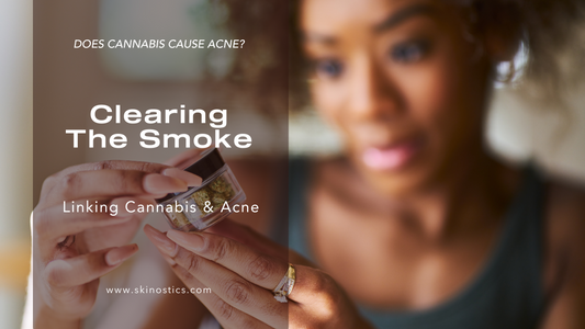 Linking Cannabis & Acne