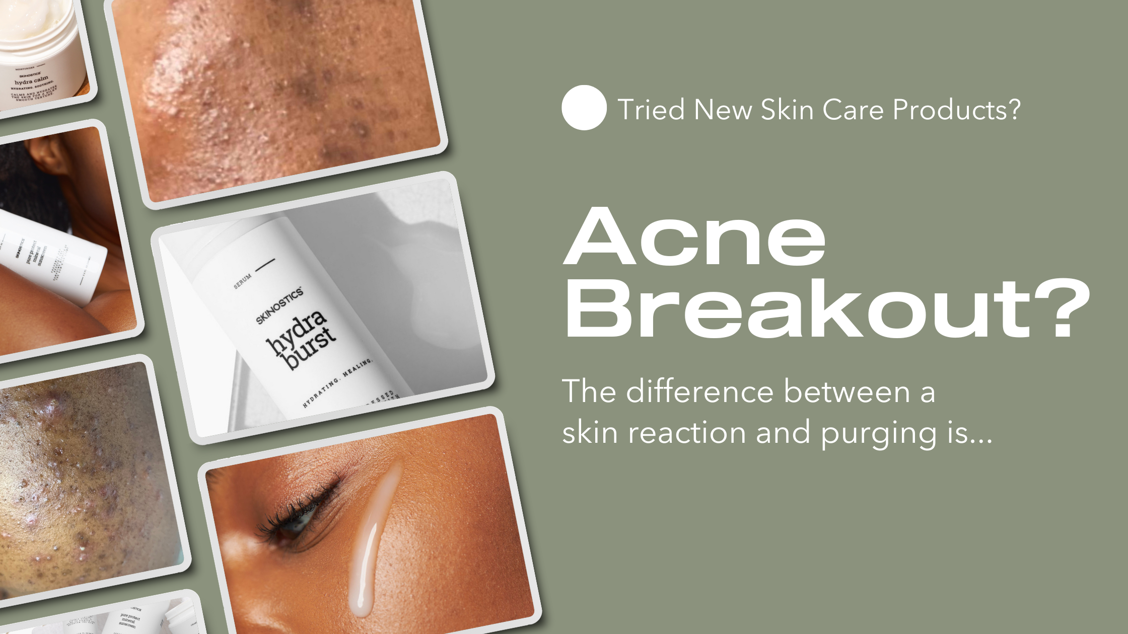 Is Your Skin Purging or Breaking Out? – Skinostics
