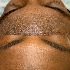 Intense Moisture Repair Kit