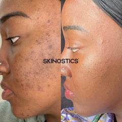 Pigment Eraser Cream